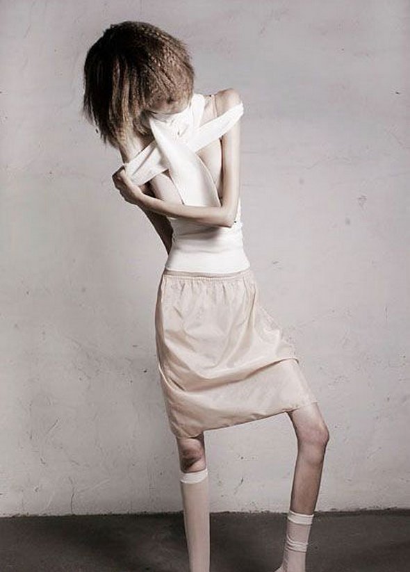Anorexic Models Dont Always Look Like Models ‹ Page 2 Of 2
